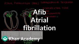 Atrial fibrillation (Afib) | Circulatory System and Disease | NCLEX-RN | Khan Academy