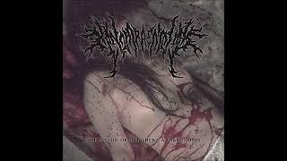 Hannaraectomy - Semen Filled Rigid Corpse