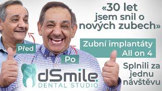 New teeth fixed in one day! Dental implants in Prague