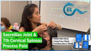 Sacroiliac joint & 7th cervical spinous process pain DU14 tx by #eileenhan #theacademyofacupuncture