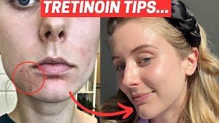 How to Use Tretinoin! The Truth About Tretinoin...