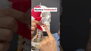 Mystery tooth ache? It could be a muscle! #tmj