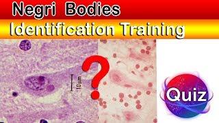 Negri bodies identification trainng Quiz  ( Increase your Skills )