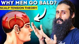 Scalp Tension Theory - The Real Reason For Hair Loss | Bearded Chokra