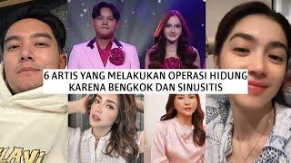 6 ARTIS YANG MELAKUKAN OPERASI HIDUNG KARENA BENGKOK DAN SINUSITIS