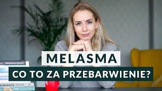 OSTUDA (Melasma) - Czym jest i jak się jej pozbyć? 