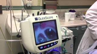 Glidescope