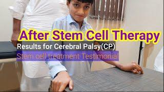 Video 3 /After stem cell treatment results for cerebral palsy(CP) | Testimonial |Dr. Khaqan J Janjua