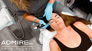 Hydrafacial Syndeo - Take Your Skin To The Next Level