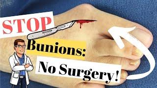 Bunion Home Treatment [Top 7] Bunion Correctors, Splints & Gel Pads!