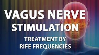 Vagus Nerve Stimulation - RIFE Frequencies Treatment - Energy & Quantum Medicine with Bioresonance