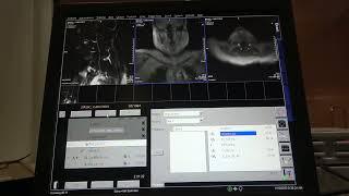 Basic Carotids MRI