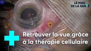 Une thérapie cellulaire pour éviter la cécité - Le Magazine de la Santé