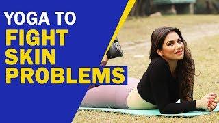 Yoga To Fight Skin Problems | मुंहासों से छुटकारा दिलाएंगे यह योगासन, त्वचा भी खूब चमकेगी