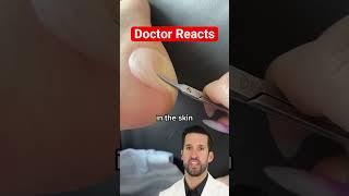 ER Doctor REACTS to Foot Blister