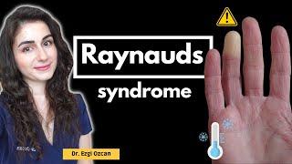 Raynaud's Syndrome: Causes, Symptoms, and Effective Management