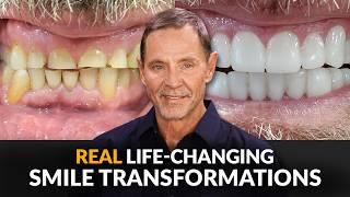 5 Amazing Smile Transformations Without a Dentist!