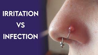 Body Piercer Explains: Irritation and Piercing Bumps