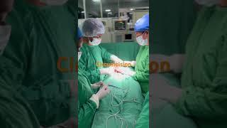 Adult circumcision by Dr RJK Senevirathne VS #circumcision #surgeon #kandyspecialist 🩺