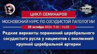 Гуцалюк Алексей Георгиевич, Салимов Кирилл Алексеевич «Окклюзия ВСА вследствие диссекции»