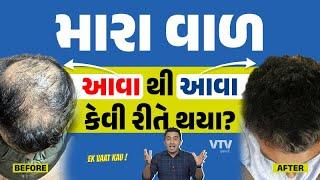 કઈ રીતે મારા વાળ પાછા આવ્યા? | Ek Vaat Kau