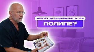 ИНТЕРВЬЮ С ДОКТОРОМ.ЧТО ТАКОЕ ПОЛИП У ЖЕНЩИН? БЕРЕМЕННОСТЬ ПРИ ПОЛИПЕ #медицина #советы #интервью