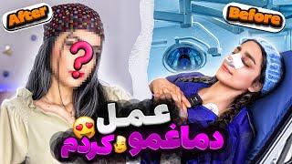 دماغمو عمل کردم  چه شکلی شدم ⁉️