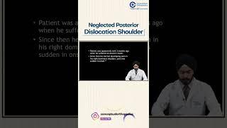 Neglected Posterior Dislocation Shoulder By Dr. Harpreet Singh | Orthopedic Residency