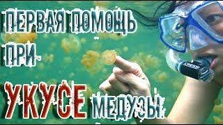 ЗдоровьеПервая помощь при укусе медузыЭто полезно знать
