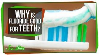 Why Is Fluoride Good for Teeth?