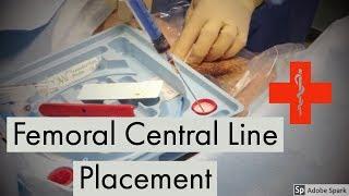 Femoral Central Line Placement