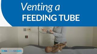 How to vent a feeding tube