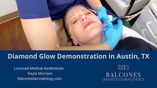 Diamond Glow Treatment Demo | Balcones Dermatology & Aesthetics | Austin, TX | Ph: 512-459-4869