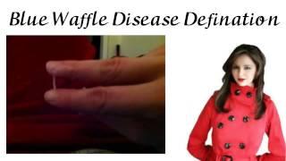 Blue Waffle Definition