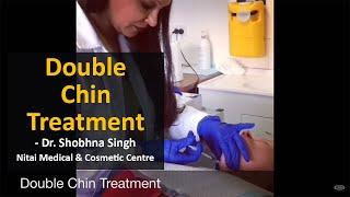 Double Chin Treatment | How to get rid of Double Chin | Nitai Medical & Cosmetic Centre