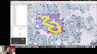 Response to 'Detecting (Positive) Cells with QuPath'