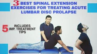 BEST WAY TO PERFORM SPINAL EXTENSION EXERCISES IN ACUTE LUMBAR PIVD(Sciatica)