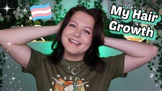 My Hair Growth and whats helped | Luna Rose Transgender Journey MTF