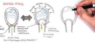 Obstetrics - Stage I of Labour