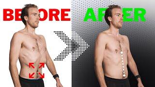 How To ACTUALLY Fix Your Rib Flare For GOOD