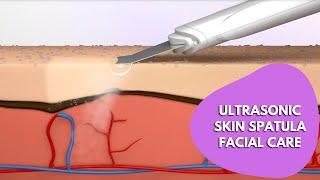 Ultrasonic Skin Spatula Facial | Ultrasonic Skin Scrubber Spatula| Blackhead Removal Exfoliation