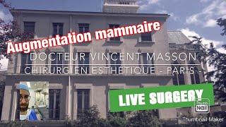 CHIRURGIE EN DIRECT AUGMENTATION MAMMAIRE PAR PROTHÈSES