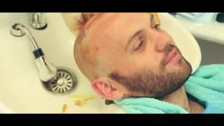 Richard's FUE Hair Transplant at The Private Clinic