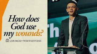 How Does God Use My Wounds? | Tauren Wells