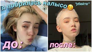 Я Побрилась Налысо (волосы ТОЧНО ПОКИНУЛИ ЧАТ)