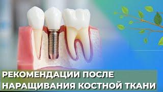 Рекомендации после наращивания костной ткани