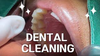 [Seoul Dentist] Teeth are cleaned at the Dental Clinic