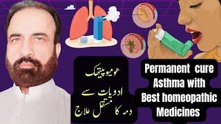 Best Homeopathic Medicines for Asthma |Top Homeopathic Remedies To Relieve Asthma|