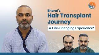 Bharat's Transformation: From Hair Loss to Confidence - A Hair Transplant Journey | @alloroots