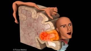 Primary Motor Cortex - Neuroanatomy